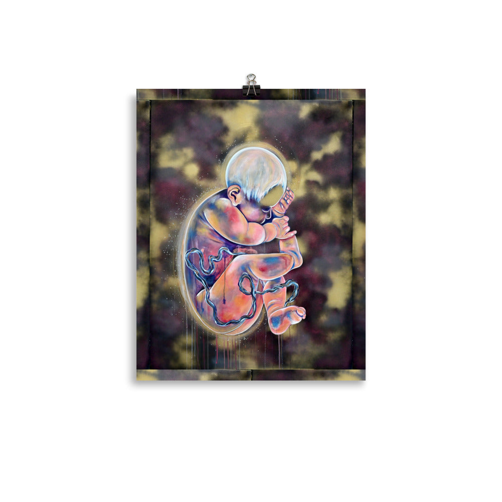 Utero